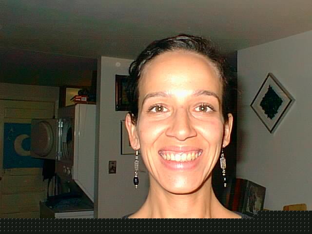  Rebecca gets her braces off 